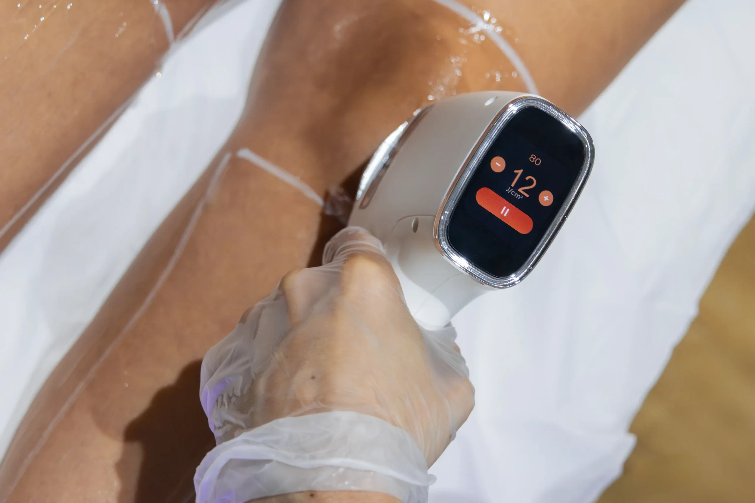 Illustration du service